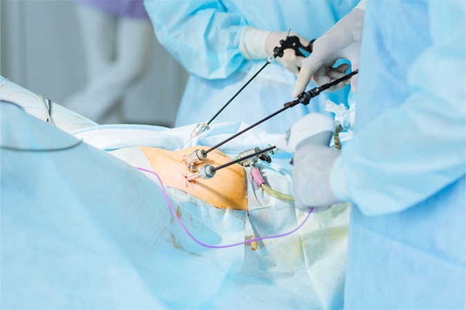 Laparoscopic Surgery